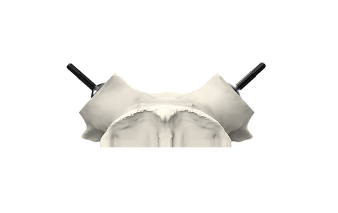 Universal Whitetail Skull Plate - Powered by Rack Hub®