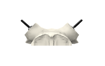 Universal Whitetail Skull Plate - Powered by Rack Hub®